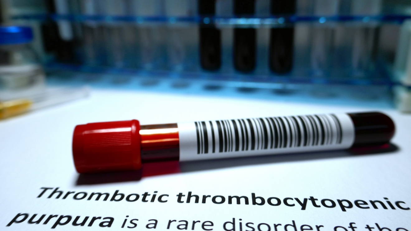Thrombocytopenic purpura thrombotic